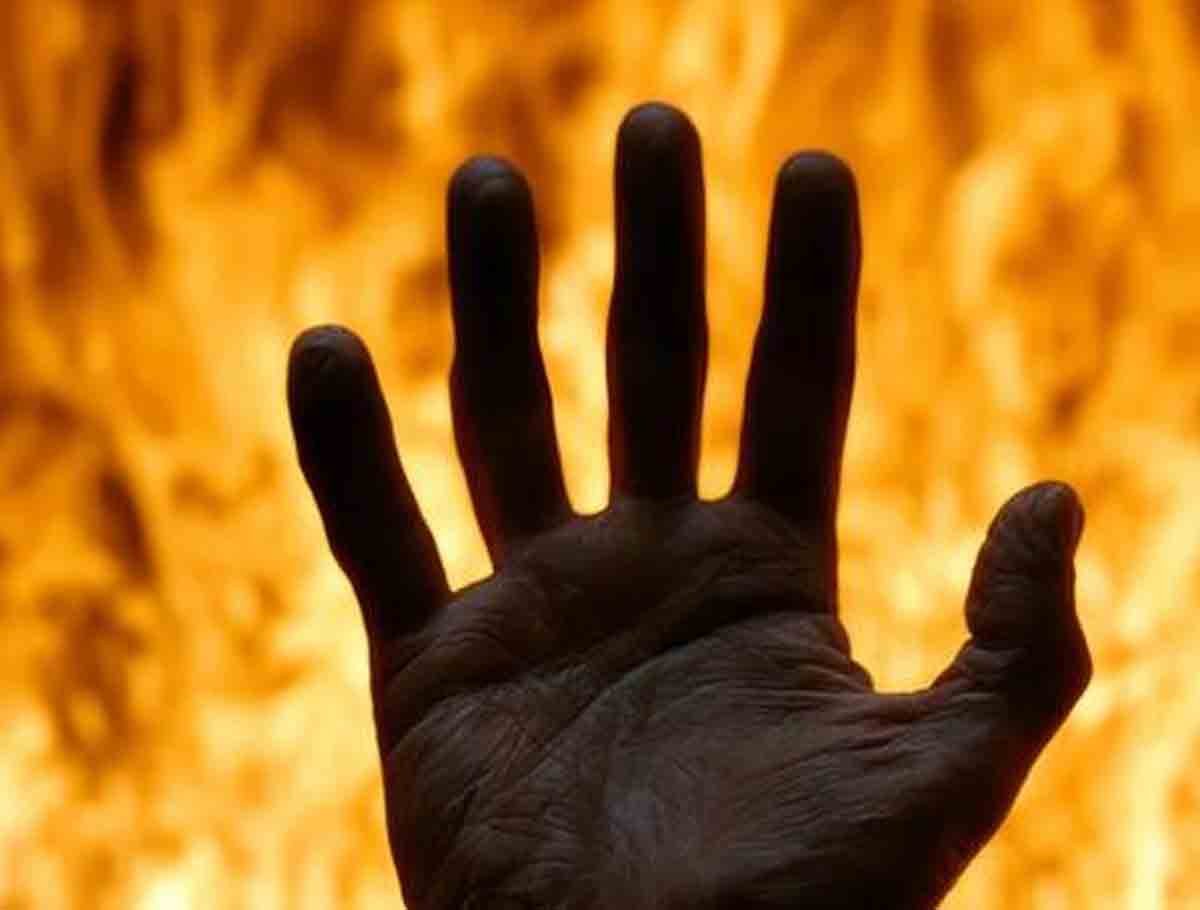 Karimnagar Man Sets Self Ablaze After Wife Separation